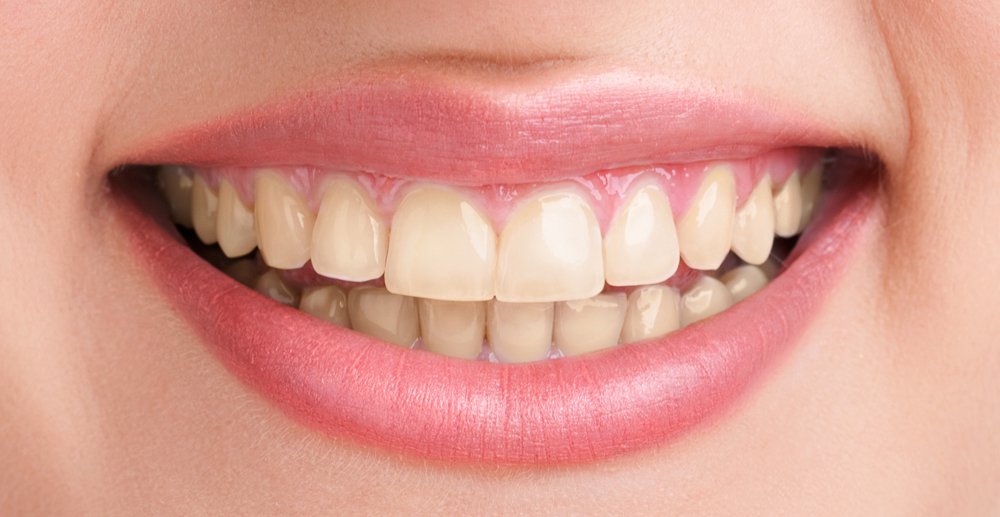 smile_2