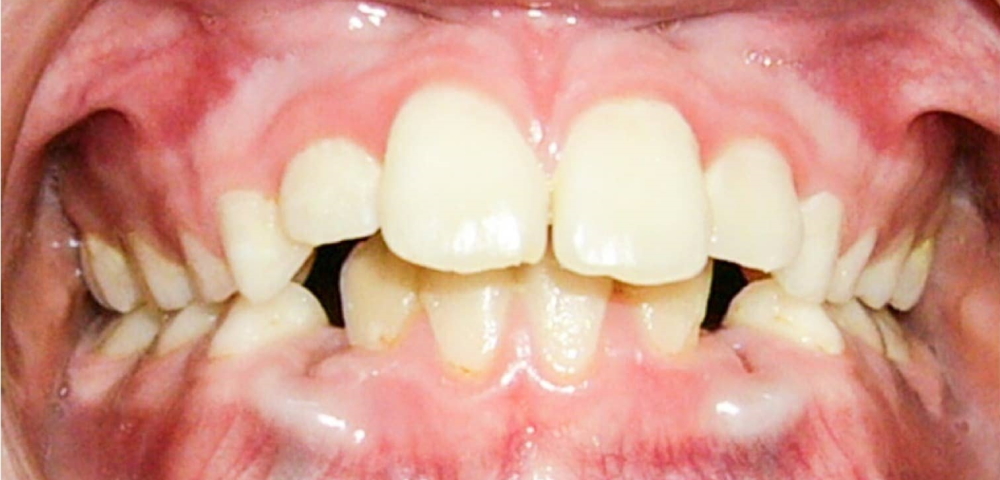 before_3