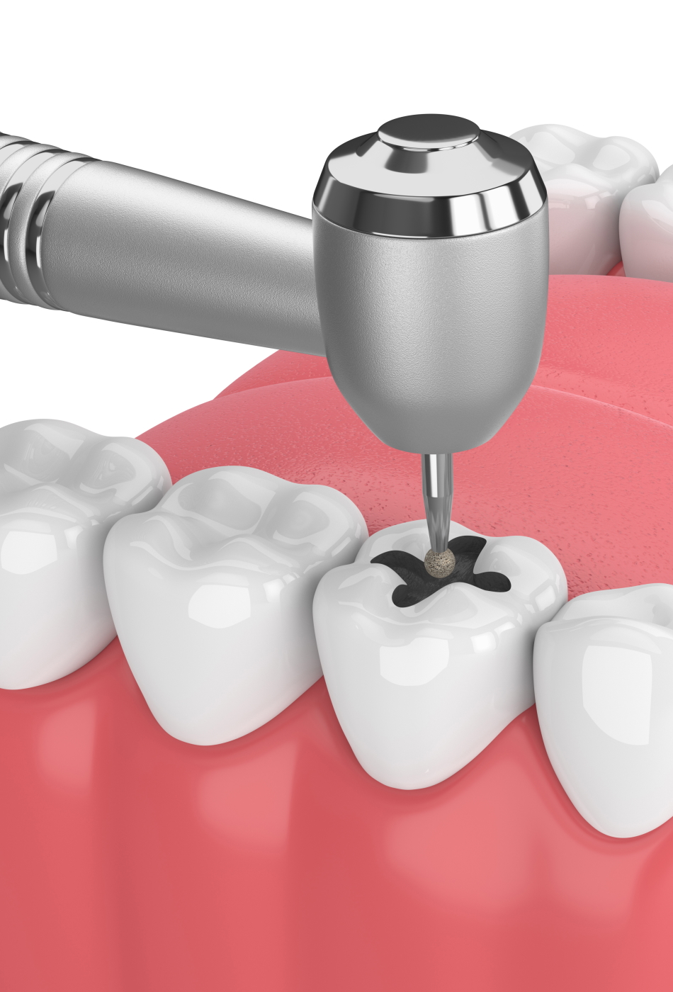 dental_1